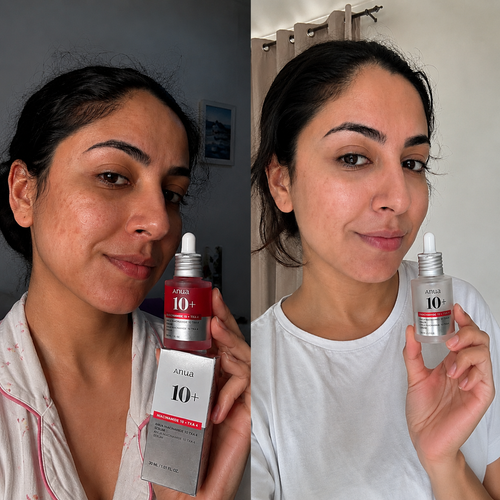 ANUA Niacinamide 10% + TXA 4% Serum