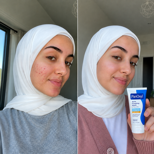 Panoxyl Acne Creamy Wash Benzoyl Peroxide 4%