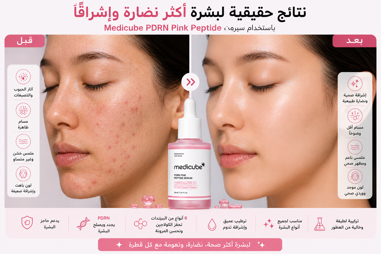قبل وبعد Medicube PDRN PINK