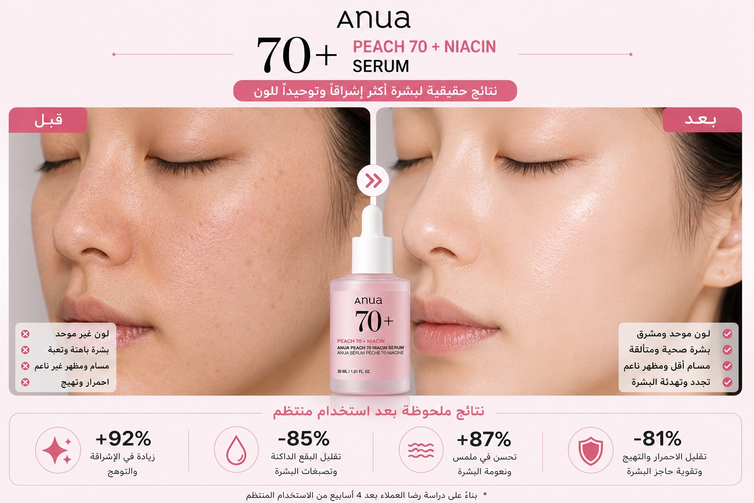 قبل وبعد ANUA Peach 70% Niacinamide Serum 30ml